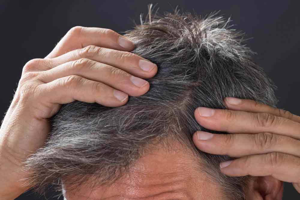 What Stress Can Do To Your Hair Will Shock You